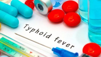 typhoid-fever